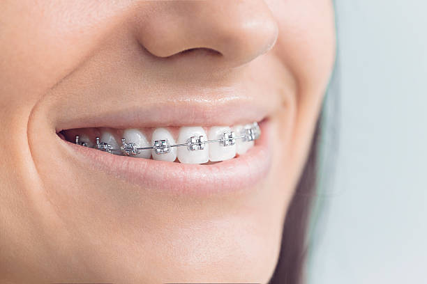 Dental Inlays and Onlays in Cosmopolis, WA